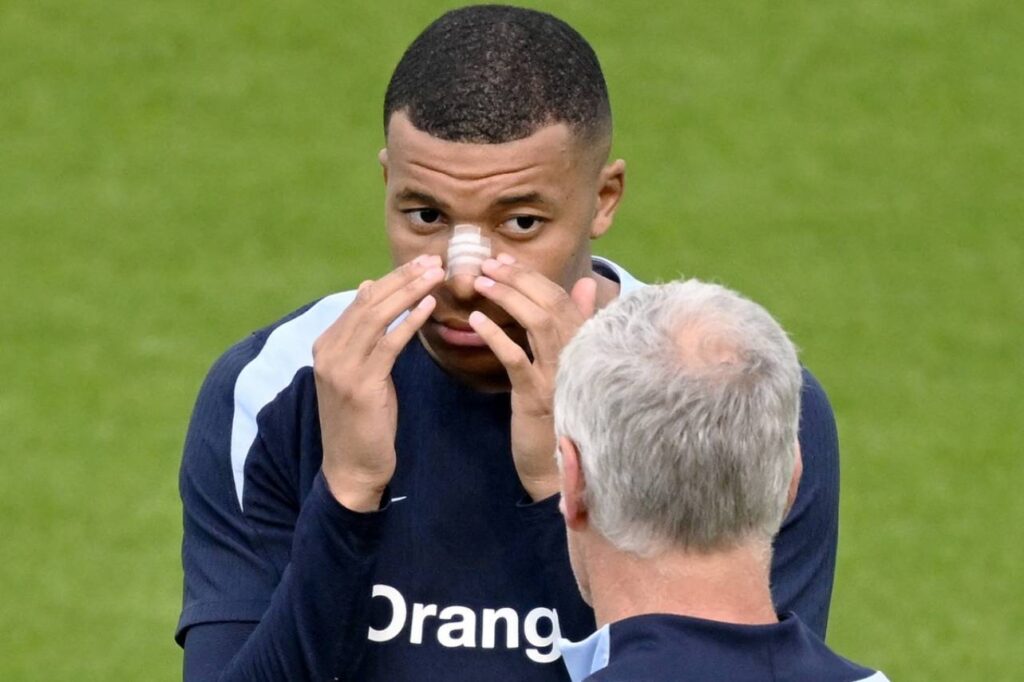 Mbappé deve usar uma máscara na próxima rodada da Euro. Foto: FRANCK FIFE/AFP