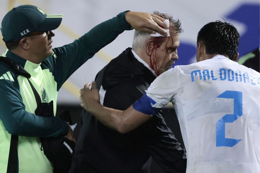 Javier Aguirre, treinador do México, foi atingido por garrafa na cabeça (Foto: Jhony Magallanes/AFP)